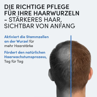 Ein Mann mit schütterem Haar auf der linken und vollem Haar rechts, dazu Text zur Haarpflege mit dem Dr. Balwi Hair Boost Set von Dr. Balwi Shop für die Aktivierung von Stammzellen und den natürlichen Haarwachstumsprozess.