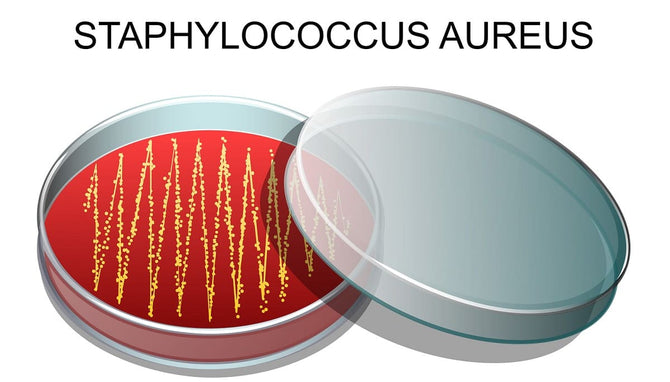 Chute de cheveux causée par Staphylococcus aureus – Que faire ?