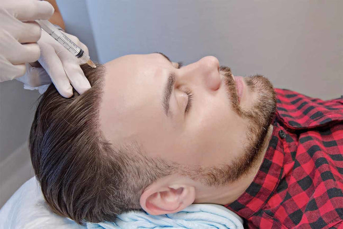 Vampire Lifting gegen Haarausfall: Ein innovativer Ansatz zur Behandlung von Haarproblemen