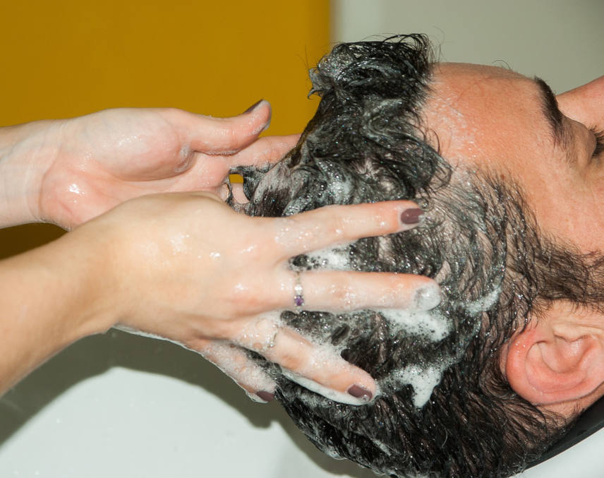 can hair loss shampoo counter a baldness issue