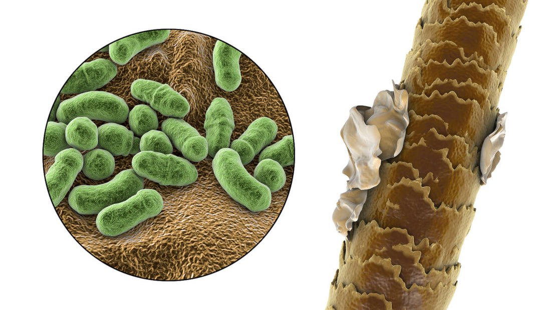 folliculitis is mainly caused by the malassezia genus of yeasts