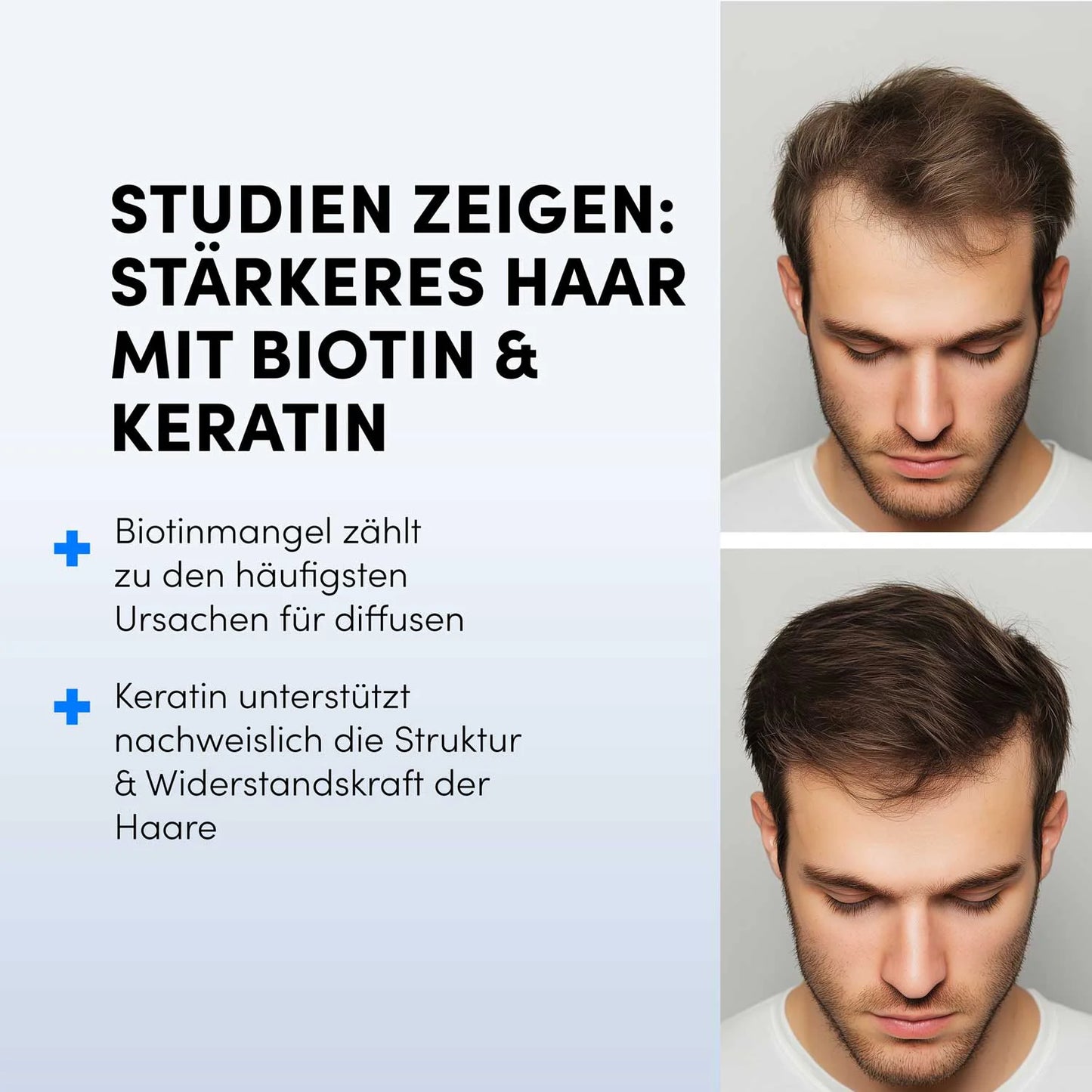 Zwei Fotos eines jungen Mannes: oben mit dünnerem, unten mit kräftigerem Haar. Links Text: "Studien zeigen: Stärkeres Haar mit Biotin & Keratin Tabletten von Dr. Balwi Shop" plus kurze Infos zum Einfluss auf das Haarwachstum.
