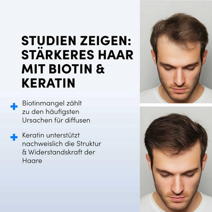 Zwei Fotos eines jungen Mannes: oben mit dünnerem, unten mit kräftigerem Haar. Links Text: "Studien zeigen: Stärkeres Haar mit Biotin & Keratin Tabletten von Dr. Balwi Shop" plus kurze Infos zum Einfluss auf das Haarwachstum.