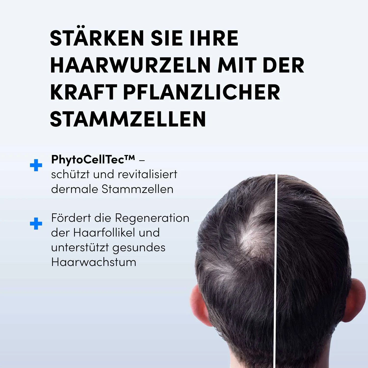 Ein Mann mit lichtem Haar am Hinterkopf, daneben Text: "Dr. Balwi Hair Boost Set von Dr. Balwi Shop stärkt Ihre Haarwurzeln dank pflanzlicher Stammzellen - für weniger Haarausfall und besseres Haarwachstum.