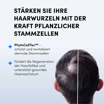 Ein Mann mit lichtem Haar am Hinterkopf, daneben Text: "Dr. Balwi Hair Boost Set von Dr. Balwi Shop stärkt Ihre Haarwurzeln dank pflanzlicher Stammzellen - für weniger Haarausfall und besseres Haarwachstum.