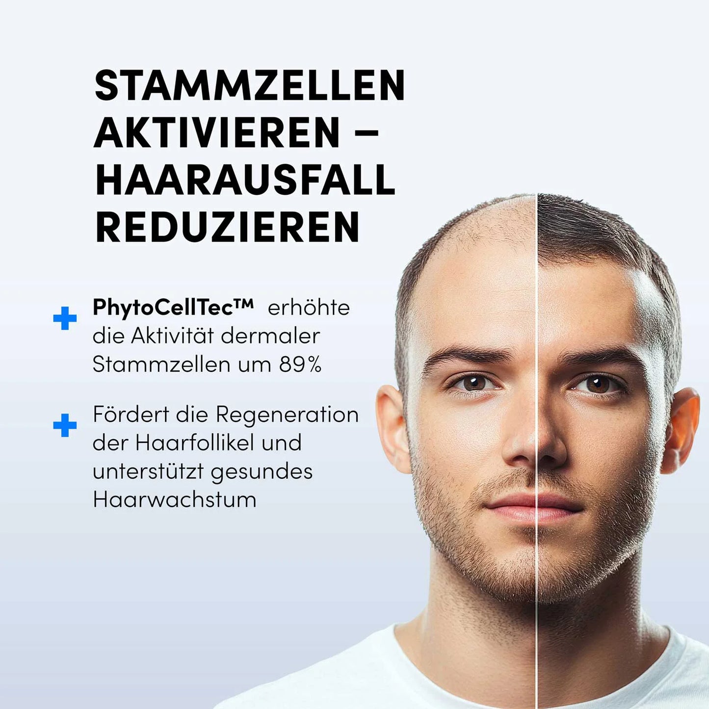 Das Gesicht eines jungen Mannes ist in zwei Hälften geteilt: links ist der Haarausfall zu sehen, rechts das volle Wachstum. Der deutsche Text wirbt für das Dr. Balwi Hair Boost Set aus dem Dr. Balwi Shop, das die Stammzellenaktivierung zur Reduzierung von Haarausfall und zur Unterstützung des Haarwachstums hervorhebt.