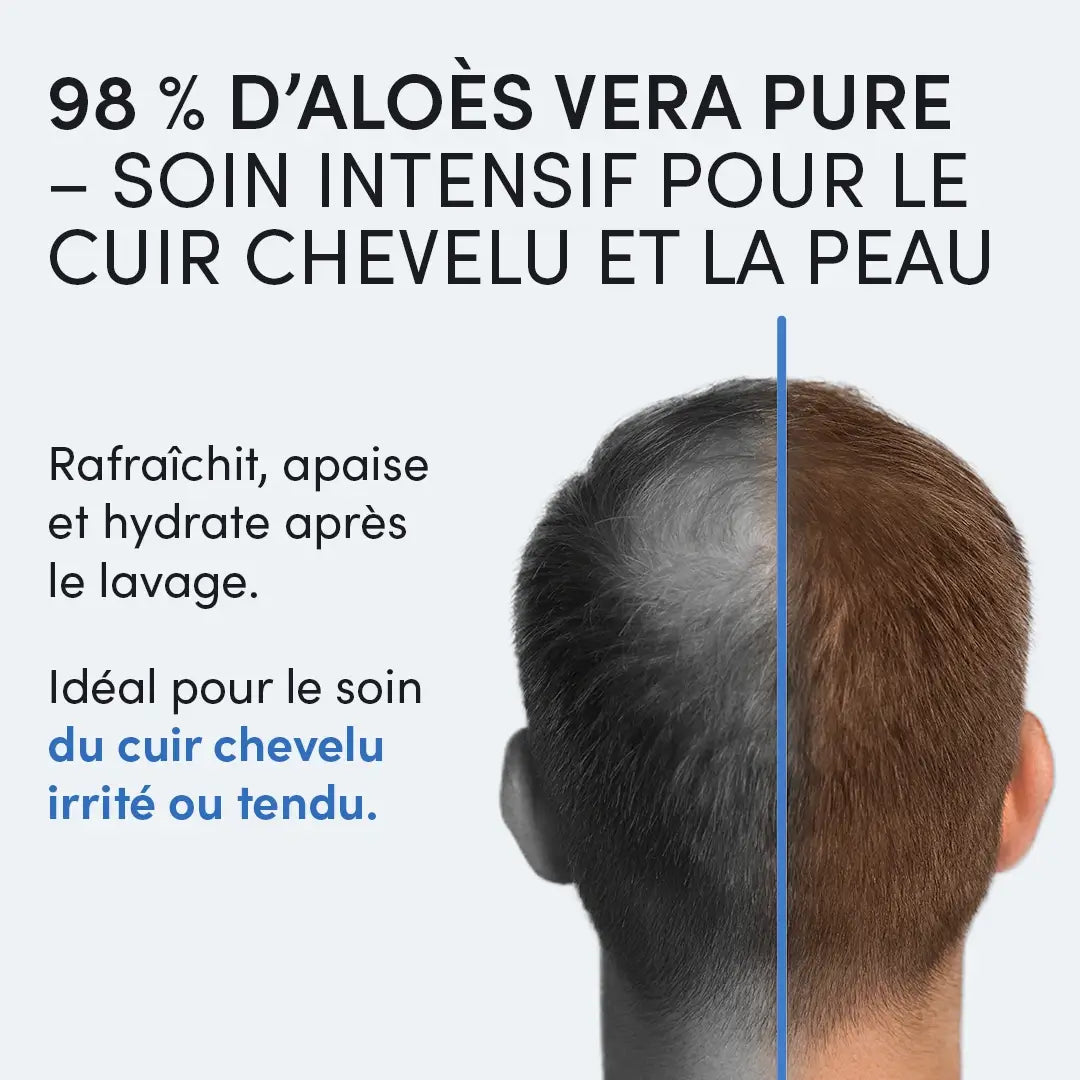 Gel d'Aloe Vera 98 % Dr. Balwi
