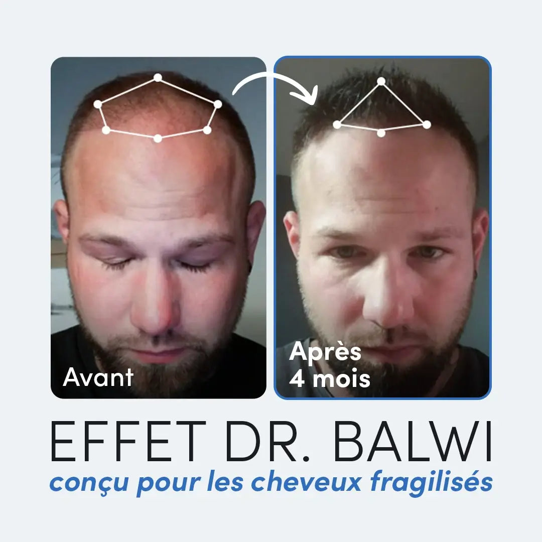 Routine anti-chute de cheveux