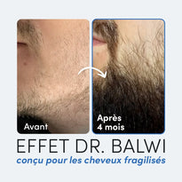 Gegenüberstellung des Bartes eines Mannes: links spärliche Gesichtsbehaarung mit der Aufschrift Avant, rechts vollerer Bart mit der Aufschrift Après 4 mois. Der Text darunter lautet: Effet Dr. Balwi conçu pour les cheveux fragilisés.