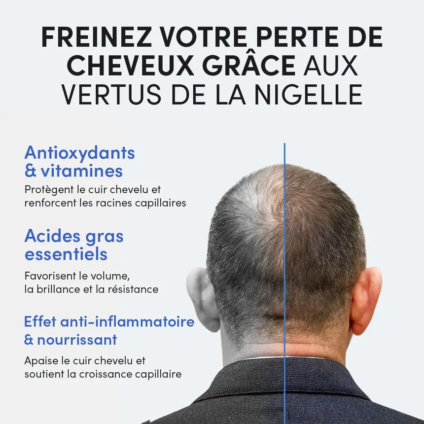Ein Mann mit schütterem Haar am Hinterkopf blickt weg. Der Text hebt die Vorteile von Schwarzkümmel für das Haar hervor: Antioxidantien, Vitamine, essenzielle Fettsäuren und entzündungshemmende Wirkungen, die den Haarausfall reduzieren und das Wachstum fördern.