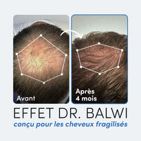 Nahaufnahme des Oberkopfes einer Person vor (links) und nach (rechts) 4 Monaten, die eine erhöhte Haardichte zeigt. Französischer Text: Effet Dr. Balwi conçu pour les cheveux fragilisés.