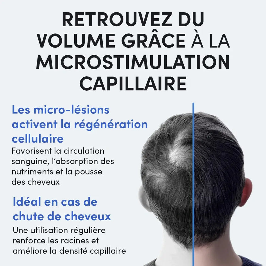 Ein Mann mit schütterem Haar auf dem Oberkopf wird von hinten gezeigt. Der französische Text beschreibt die Vorteile der Mikrostimulation der Kopfhaut für die Haardichte, die Regeneration und die Vorbeugung von Haarausfall.