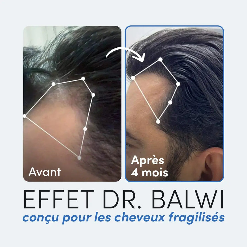 Kit Hair Boost Dr. Balwi