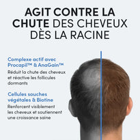 Der Kopf eines Mannes von hinten gesehen, mit schütterem Haar auf der linken Seite und vollerem Haar auf der rechten Seite. Der Text hebt die Vorteile der Haarausfallbehandlung mit Procapil™, AnaGain™, Stammzellen und Biotin für gesünderes Haarwachstum hervor.