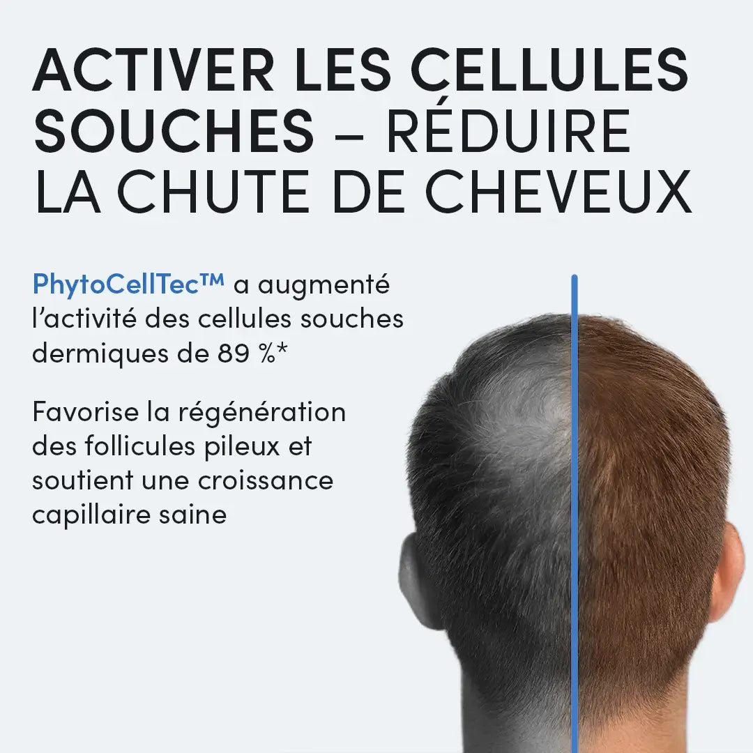 Docteur Ensemble de mésothérapie Balwi