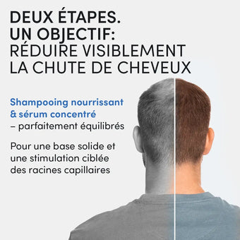 Un homme vu de dos, avec la moitié gauche de la tête dégarnie et la moitié droite avec des cheveux. Text: Zwei Etappen. Ein Ziel: Die Schamhaarspalten sichtbar zu reduzieren und Informationen über Shampoo und Creme.