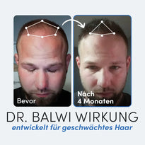 Nebeneinander liegende Fotos eines Mannes: links mit der Aufschrift "Bevor" mit schütterem Haar, rechts mit der Aufschrift "Nach 4 Monaten" mit glattem Haar. Unten: Dr. Balwi Styling & Repair Creme von Dr. Balwi Shop mit Arganöl für geschwächtes Haar.