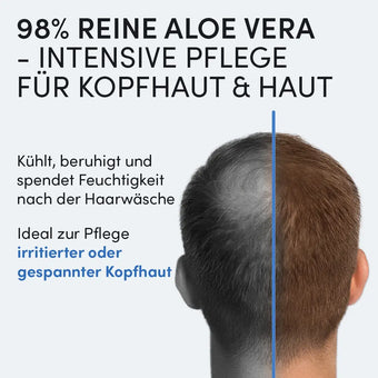 Der Kopf eines Mannes ist von hinten zu sehen - eine Seite hat gesundes, die andere schütteres Haar. Text-Highlights Dr. Balwi 98% Aloe Vera aus dem Dr. Balwi Shop für Feuchtigkeitspflege Haare und trockene Kopfhaut, zur beruhigenden, feuchtigkeitsspendenden Kopfhaut- und Hautpflege.