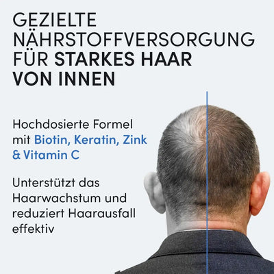 Ein Mann mit schütterem Haar von hinten gesehen. Deutscher Text wirbt für Dr. Balwi Shop Biotin & Keratin Tabletten mit Zink und Vitamin C zur Unterstützung von Haarwachstum, gezielter Nährstoffversorgung, Wachstum und reduziertem Haarausfall.