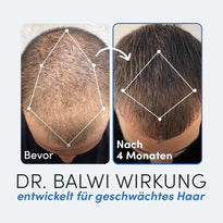 Zwei nebeneinander liegende Fotos zeigen das Haarwachstum: dünnes Haar mit der Aufschrift "Bevor" und volleres Haar nach 4 Monaten mit der Aufschrift "Nach 4 Monaten". Der Text unten hebt das Premium Schwarzkümmelöl von Dr. Balwi Shop für die Haarausfallbehandlung hervor.
