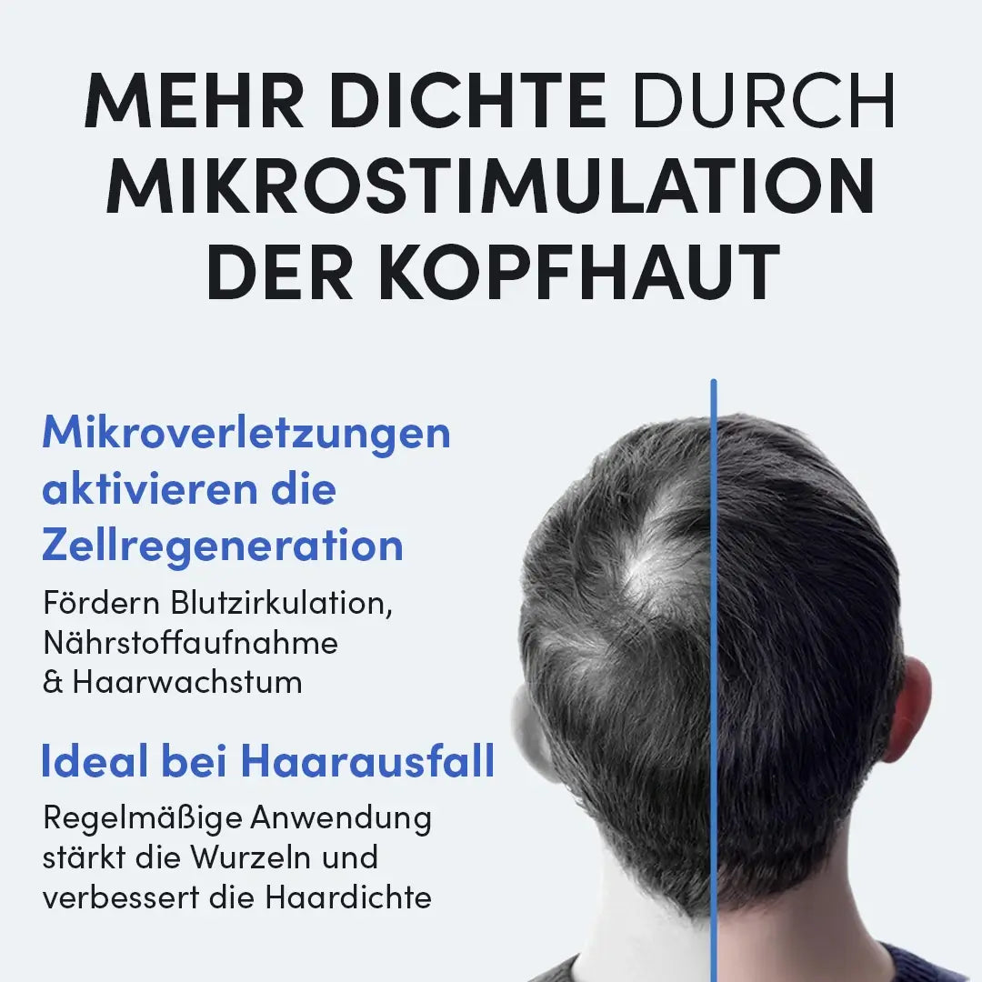 Ein Mann mit schütterem Haar von hinten. Text wirbt für den Dr. Balwi Dermaroller von Dr. Balwi Shop zur Mikrostimulation der Kopfhaut, zur Unterstützung der Zellregeneration, der Durchblutung, des Haarwachstums und der Eignung bei Haarausfall.