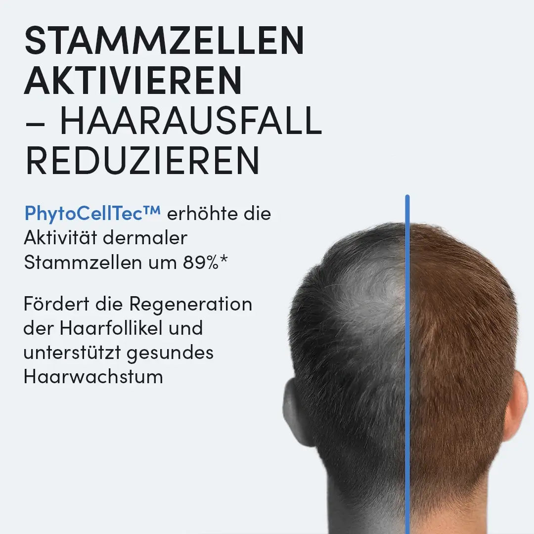 Ein Mann mit lichtem Haar am Hinterkopf steht vor hellem Hintergrund. Daneben Text zur Aktivierung von Stammzellen und Förderung des Haarwachstums durch Dr. Balwi Meso Therapie Set von Dr. Balwi Shop mit PhytoCellTec™ und Meso Serum.