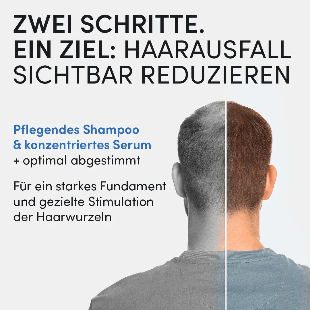 Ein Mann wird von hinten gezeigt, mit spärlichem Haar auf der linken Seite und vollerem Haar auf der rechten Seite. Der Text hebt das Dr. Balwi Shop Shampoo & Spray Set als zweistufige Lösung zur Reduzierung des sichtbaren Haarausfalls hervor.