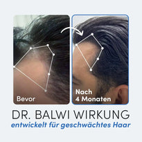 Nebeneinanderstehende Fotos zeigen den Haaransatz eines Mannes vor und nach der Behandlung. Das linke (Vorher) zeigt spärliches Haar, das rechte zeigt volleres Haarwachstum nach 4 Monaten. Der Text darunter wirbt für Zink Tabletten aus dem Dr. Balwi Shop.